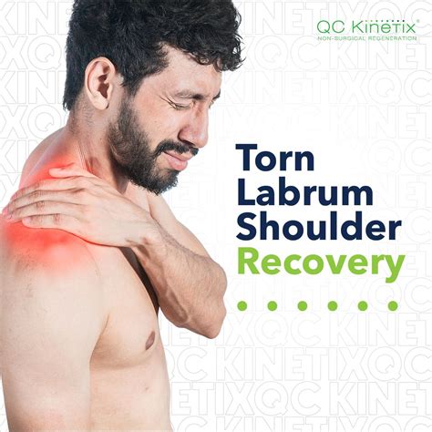 A torn shoulder labrum can be a painful and debilitating injury ...