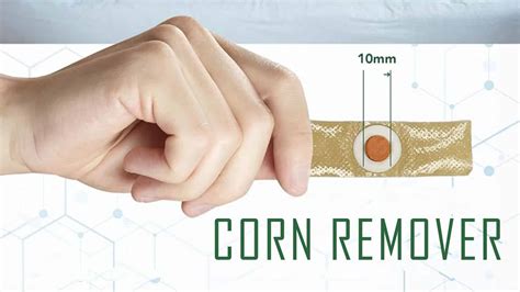 What to Know About Corn Removal Surgery Before And After