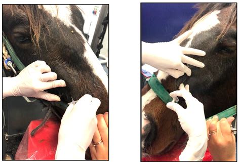 Retrograde Approach to Maxillary Nerve Block: An Alternative in ...