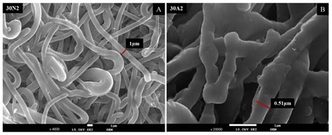 Electrospun PLGA Membranes with Incorporated Moxifloxacin-Loaded Silica ...