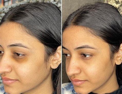 Buy Anti Dark Circle Eye Serum for Reduce Puffiness, Dark Circles ...