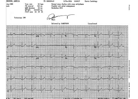 Borderline Ecg A) 12 Lead Electrocardiogram (ECG) On Presentation