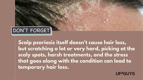 How to Prevent Hair Loss: 20 Common Causes Reviewed | UPGUYS