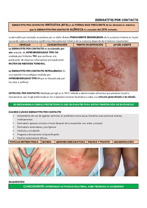 Dermatitis POR Contacto - DERMATITIS POR CONTACTO DERMATITIS POR CONTACTO IRRITATIVA (80%) es la ...
