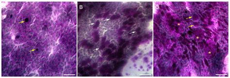 Diseases | Free Full-Text | Efficacy and Safety of Plasma Rich in Growth Factor in Patients with ...