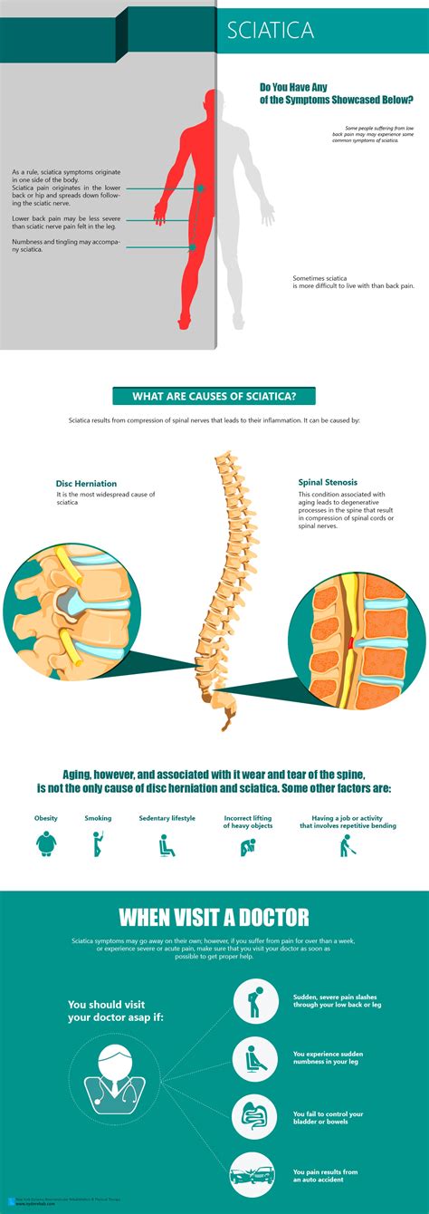 Anatomy Of Sciatica