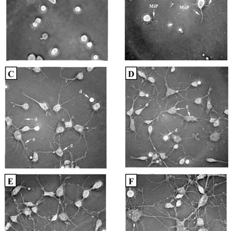 Image result for Prefrontal Cortex Mouse Brain