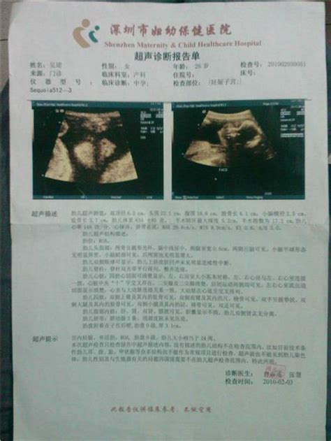 24周宝宝巴掌大 温州首例超早产儿今出院(图)_新闻中心_新浪网