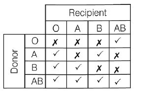 Considering ABO blood grouping system in humans, during blood ...