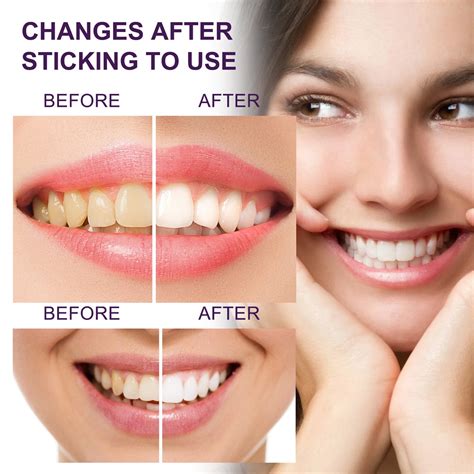 Buy EELHOE 50ml Whitening Toothpaste Stain Removal Whitening Toothpaste ...