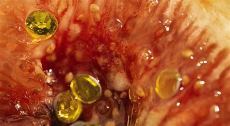 High AMH Levels: Effective Treatments & Fertility Insights