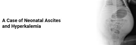 A case of neonatal Ascites and Hyperkalemia