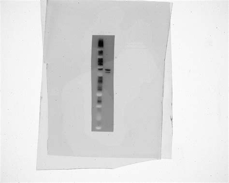NSUN2 antibody (20854-1-AP) | Proteintech