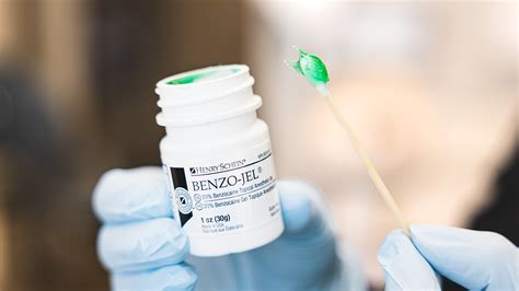 Surface Anesthesia 的图像结果