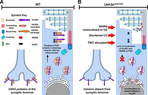 Usher Syndrome Donation Supports Usher Syndrome Research