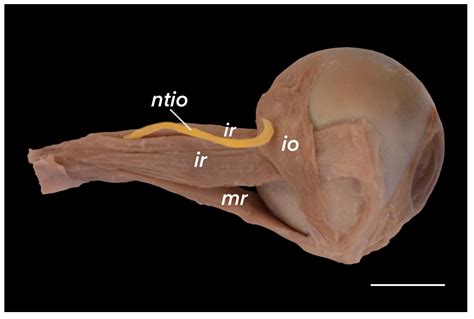 Anatomical Study of the Inferior Oblique Muscle and Its Innervation: Morphometric ...