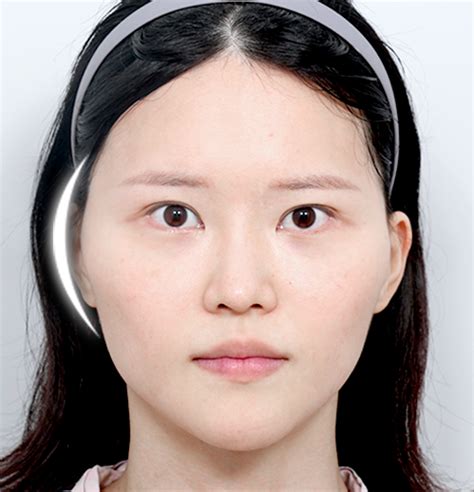 Image result for Cheekbones Reduction Book