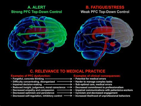 Image result for Brain Prefrontal Cortex