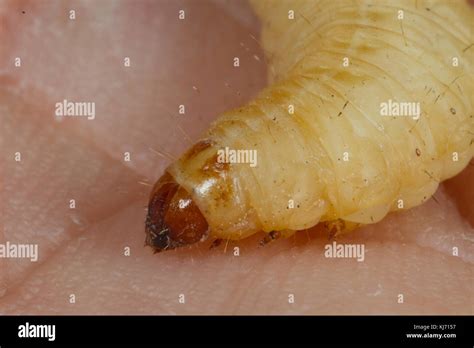 Image result for SpO2 Pleth Wave Interpretation