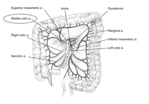 Middle Colic Artery - Stepwards