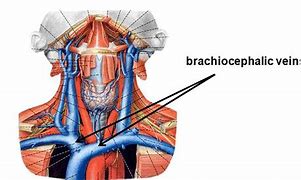 brachiocephalic 的图像结果