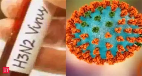 H3N2 case: H3N2 raises concerns with India witnessing rise in ICU ...