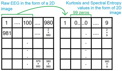 A Machine Learning Approach to Preictal Phase Detection in EEG[v1 ...