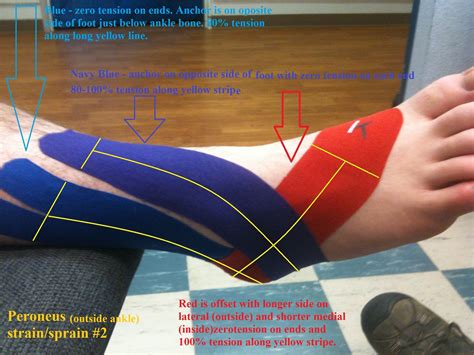 How To Wrap Sprained Ankle With Kt Tape - Luxury Product Wrapping Ideas