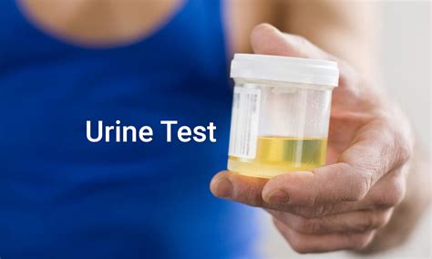 Interpretation of Urine sediment test varies significantly among kidney ...