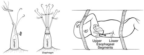 The History and Legacy of the Foker Process for the Treatment of Long ...