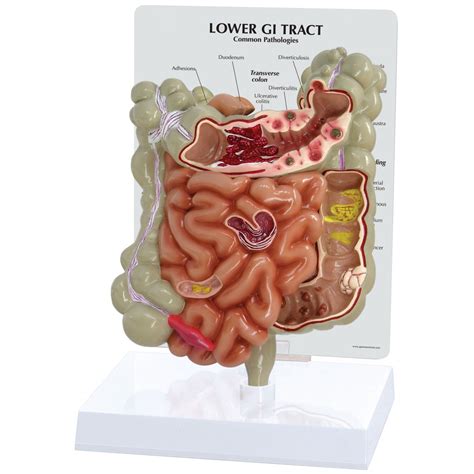 Lower GI Tract - Digestive System - Human Anatomy - Biology