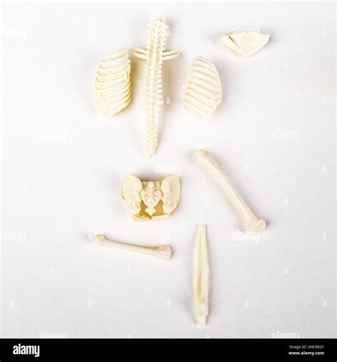 Broken bones, skeleton. Fractures, skeletal disease concept. High quality photo Stock Photo - Alamy