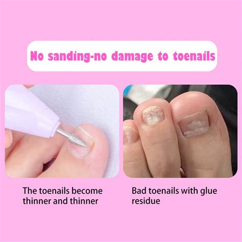 Why Do My Toenails Go White After Removing Nail Polish at Ellis Brashears blog