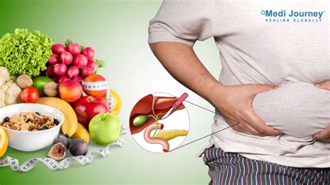 What to Eat After Gallbladder Surgery: Complete Diet Guide
