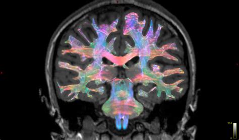 Image result for fMRI Python