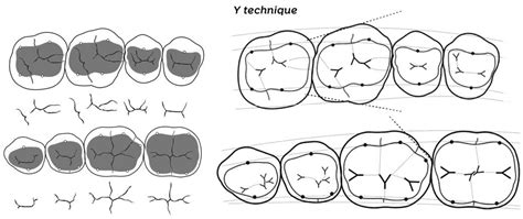 Posterior Teeth Letters