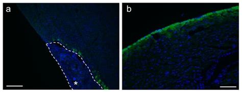 Transduction and Genome Editing of the Heart with Adeno-Associated ...