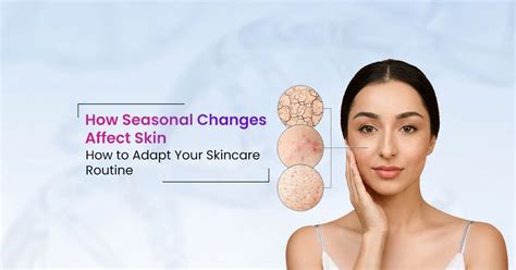 Seasonal Changes Affecting Skin: What You Need to Know – SkinInspired