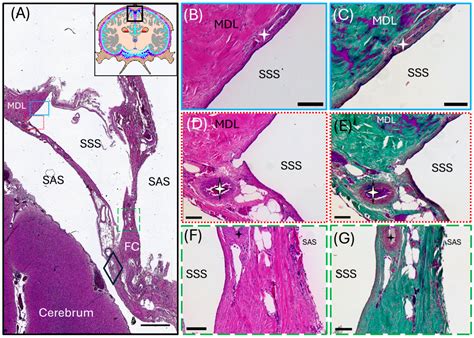 Meningeal Lymphatic and Glymphatic Structures in a Pelagic Delphinid ...