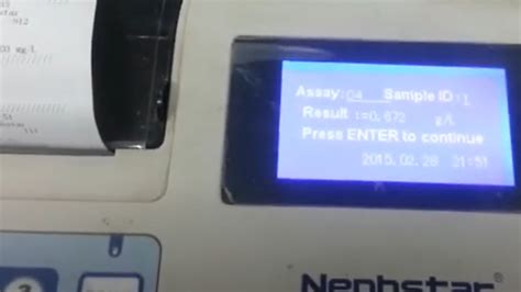 Image result for C4 Complement Blood Test