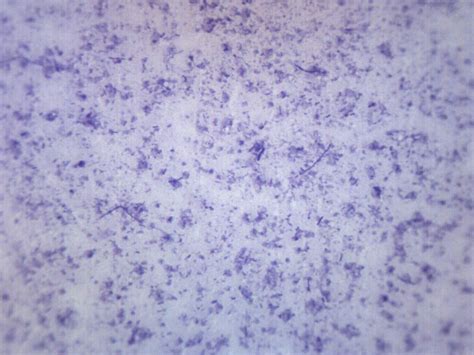 EISCO - Bacillus Culture, Gram Positive & Negative - Prepared ...