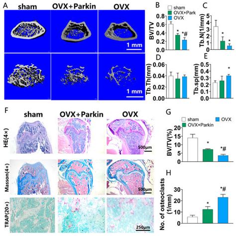 Parkin Inhibits RANKL-Induced Osteoclastogenesis and Ovariectomy ...