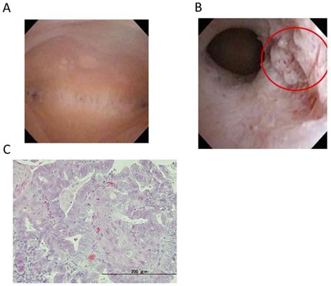 Molecular and Clinical Oncology