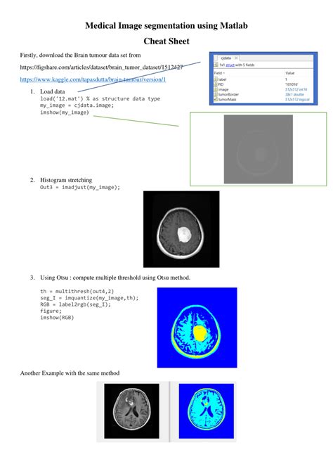Image result for Genetic Algorithm Image Segmentation MATLAB