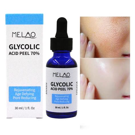 Glycolic Acid Peel 70% - Pro Skin Peel - Age India | Ubuy