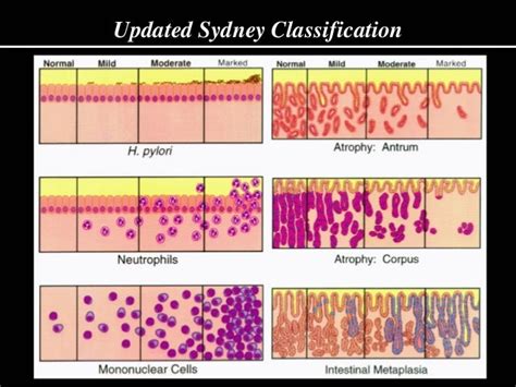 Image result for Dendrogram Image