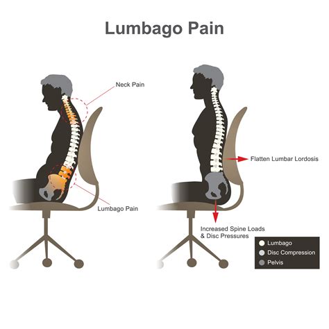 Lower Back Hurts When Sitting