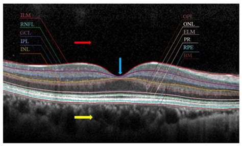 On Machine Learning in Clinical Interpretation of Retinal Diseases Using OCT Images