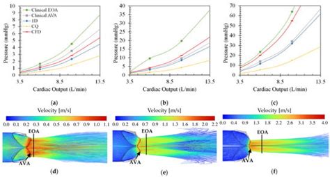 Evaluation of Aortic Valve Pressure Gradients for Increasing Severities ...