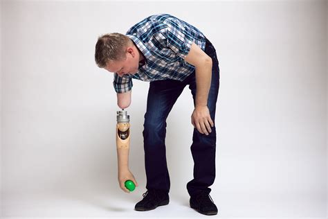 Image result for Bionic Arm Prosthetics
